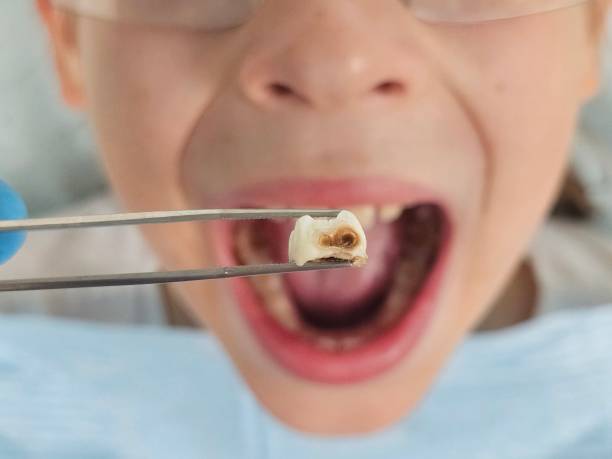 Best Emergency Treatment for Toothache in Pinch, WV